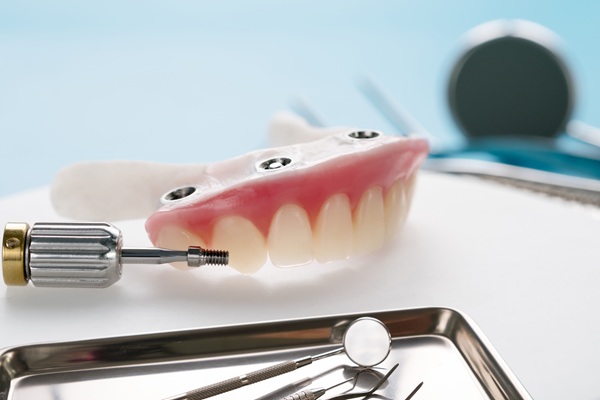 Tips To Extend The Longevity Of Implant Supported Dentures
