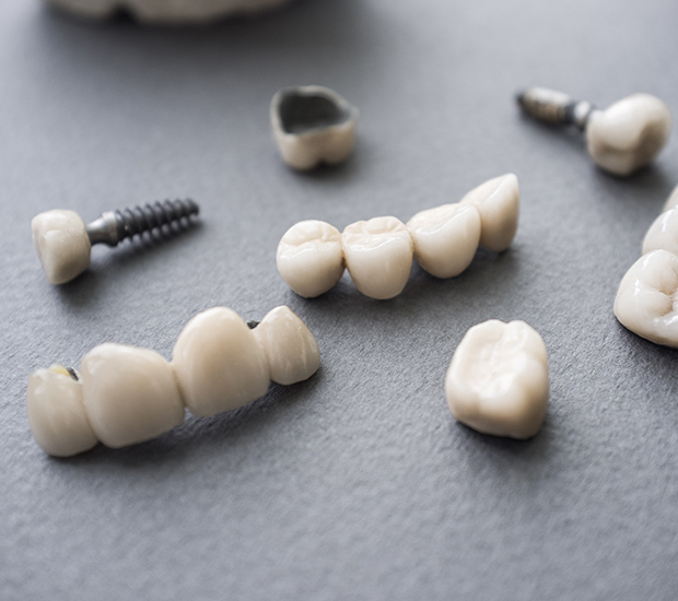 Mobile The Difference Between Dental Implants and Mini Dental Implants