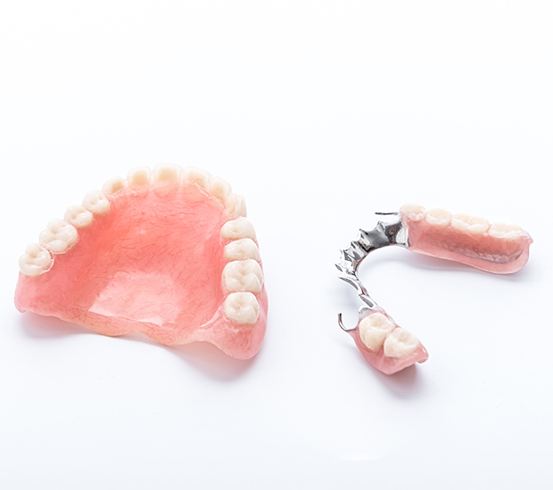Mobile Partial Dentures for Back Teeth