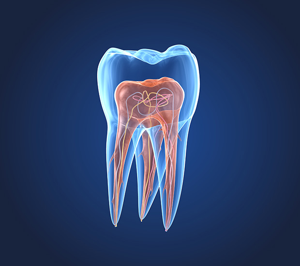 Mobile What is an Endodontist